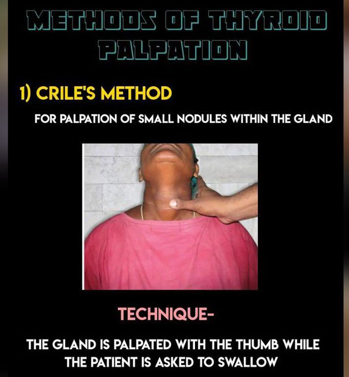 Crile's Method