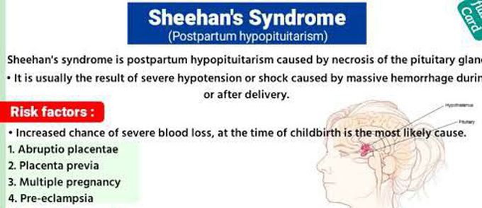 These are the risk factors of Sheehans syndrome