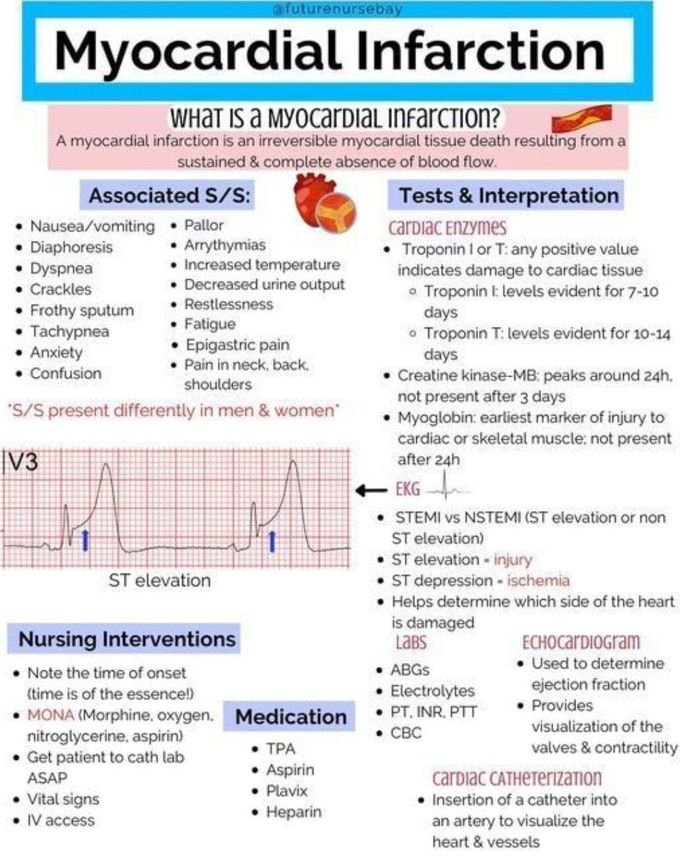 Myocardial Infarction