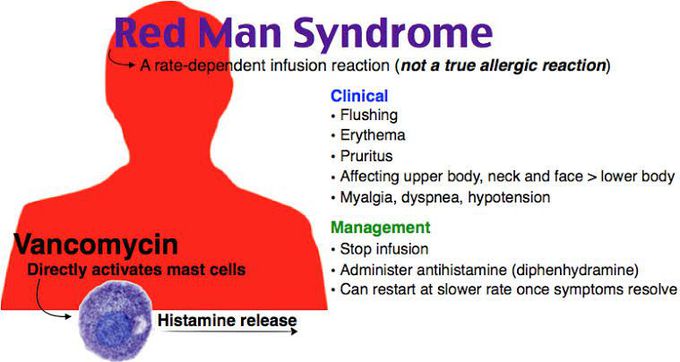 Red man syndrome