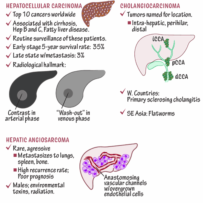 Liver and Bililary Tract tumor