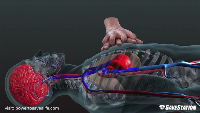 A 3D look inside the body during CPR