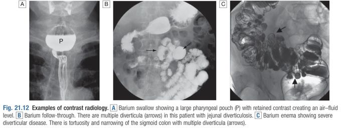 Contrast Studies in Gastrointestinal Diseases