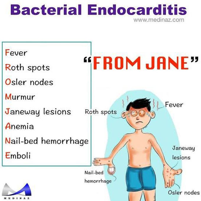 Bacterial endocarditis