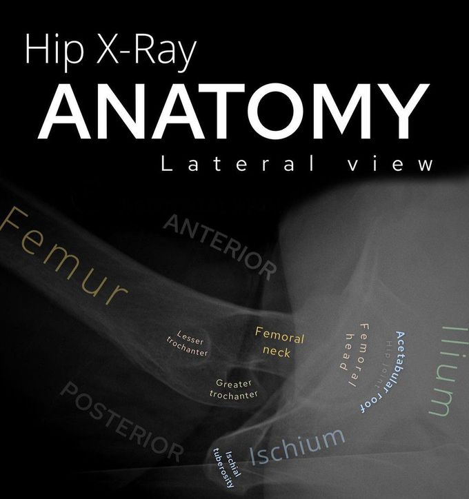 Hip X-ray Anatomy