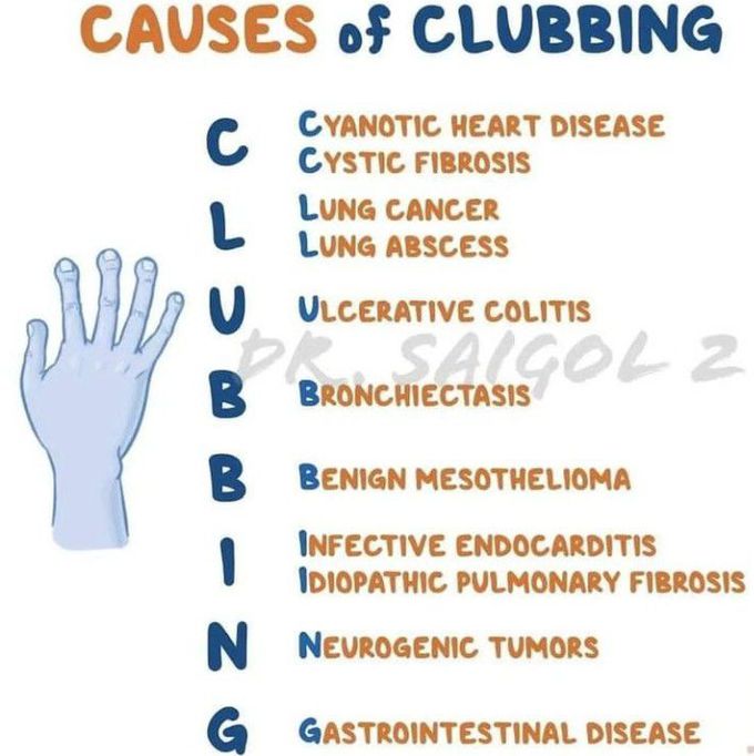 Causes of clubbing