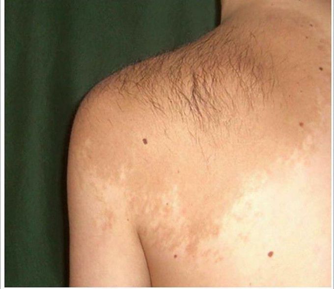 What is your diagnosis??