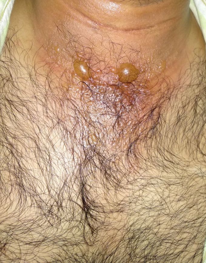 Diagnosis ??