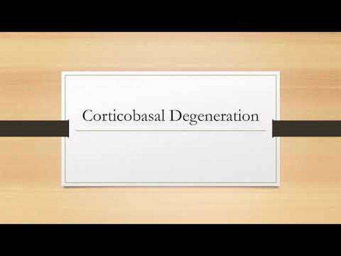 What is Corticobasal Degeneration?