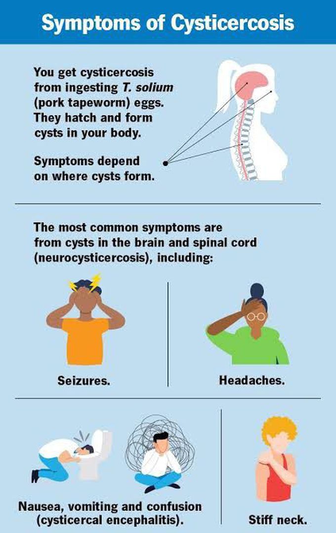 Symptoms of Cysticercosis