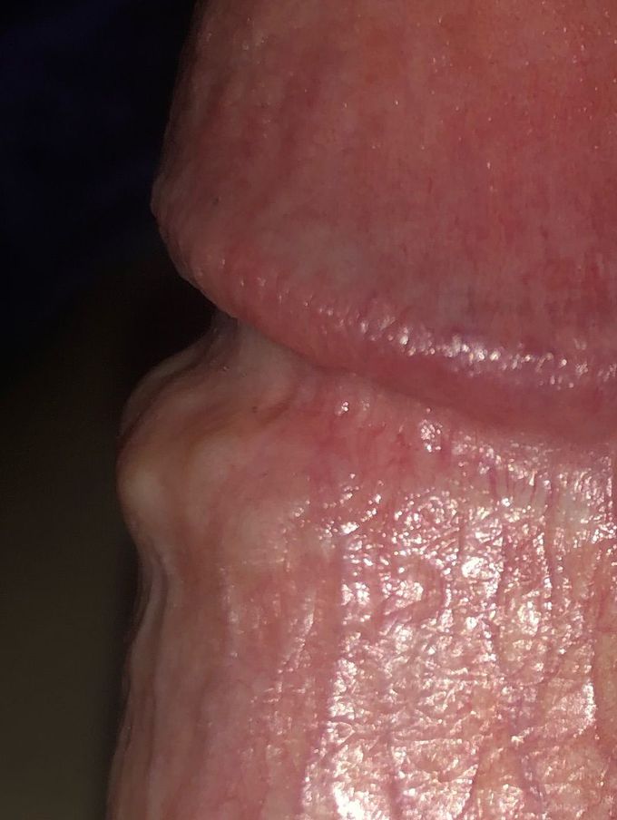 Diagnosis?