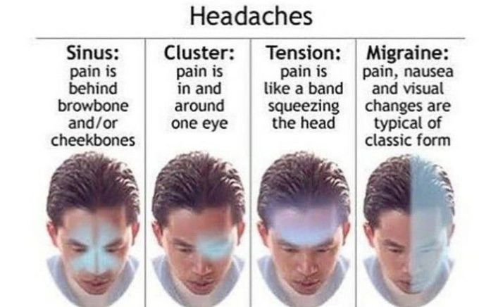 Different types of headaches
