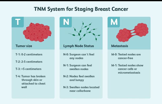 Stage of breast cancer