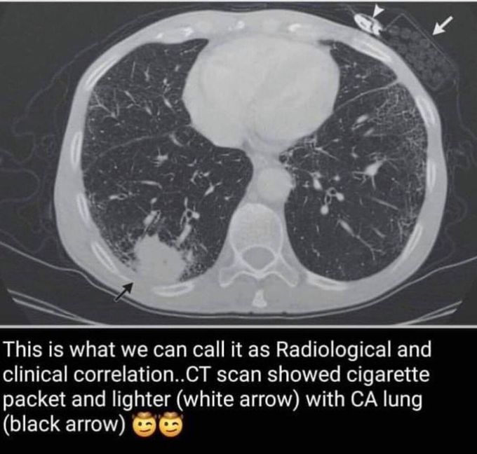 Case study
