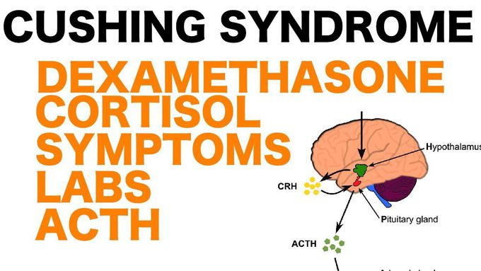 Cushing Syndrome vs. Cushing Disease vs. Ectopic Cushing