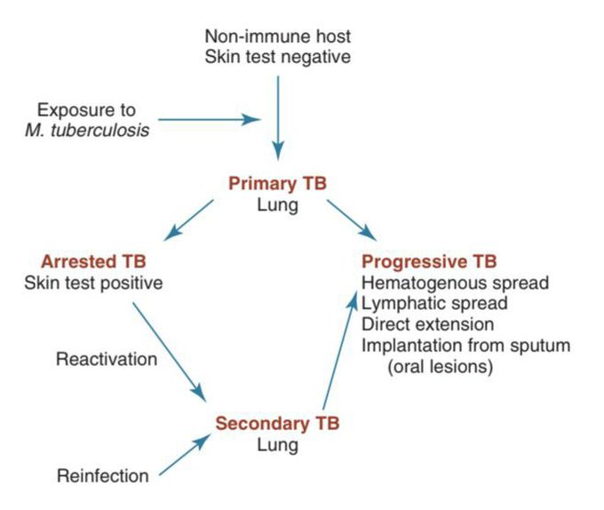 Pathogenesis of Tuberculosis