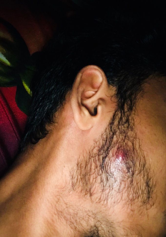 Diagnosis????