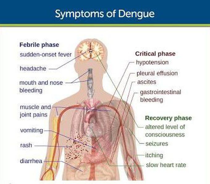 Clinical Features Of Dengue ( Phases )