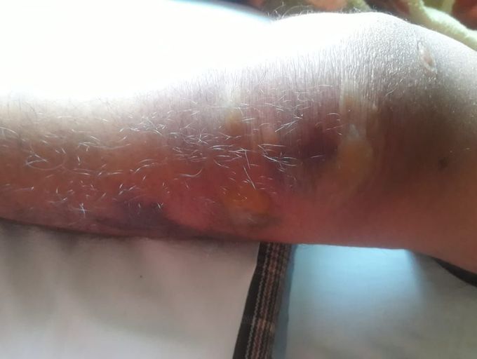 Which disease?