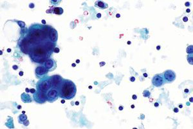 What is your diagnosis