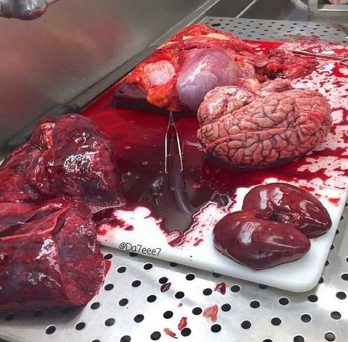 Autopsy Table