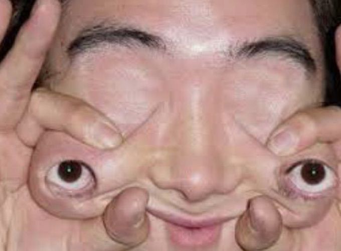 Ophtalmology