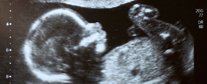Babies Kicking in The Womb Are Mapping Out Their Body And Environment, Says Study