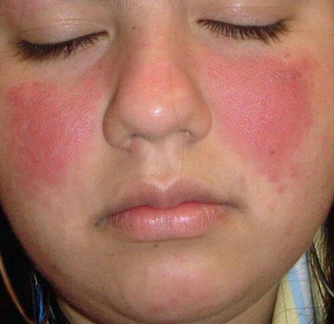 Diagnosis?