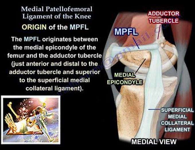 Patellar Tendon Rupture - Everything You Need To Know - Dr. Nabil Ebraheim  