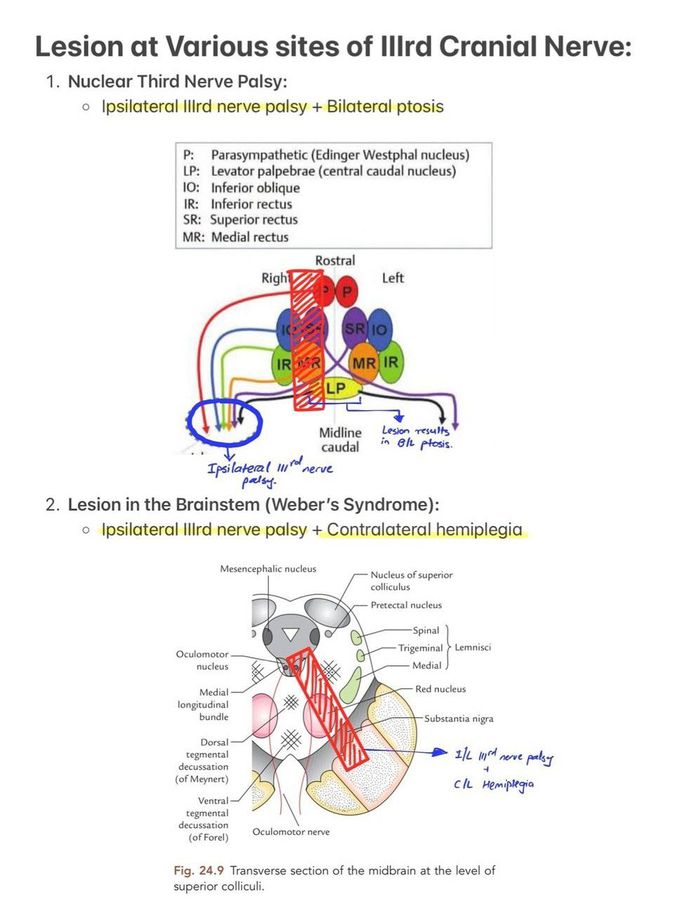 Oculomotor Nerve II