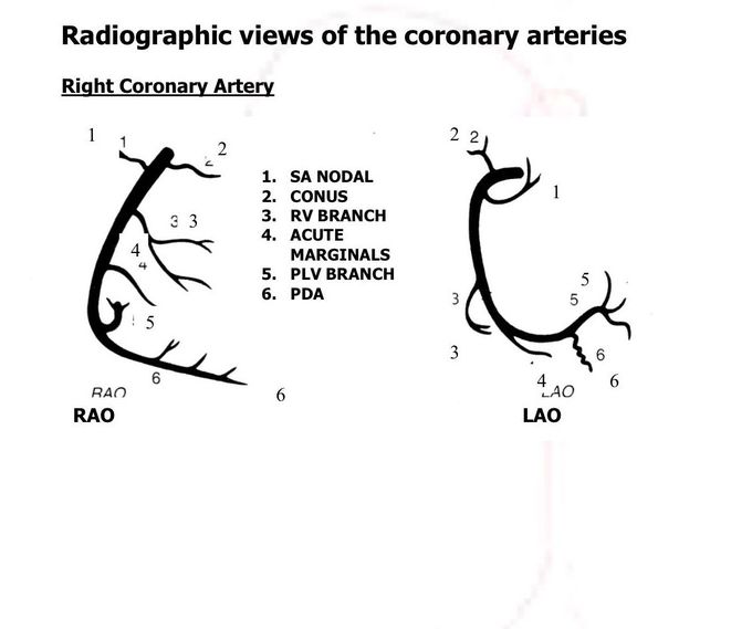 Right coronary artery angio views