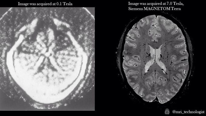 First ever human brain MR image