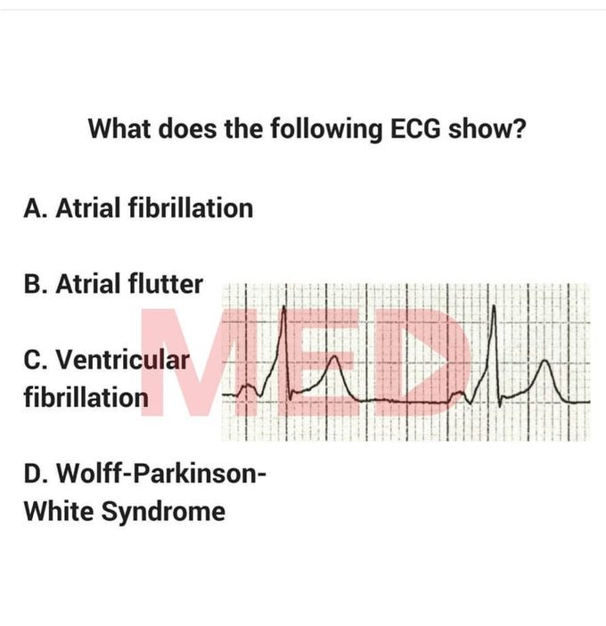 ECG .cardiology