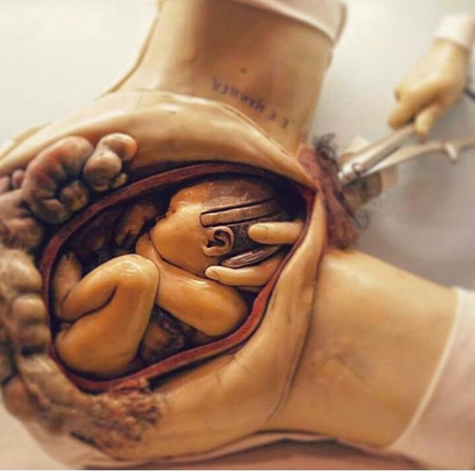Baby born Process.