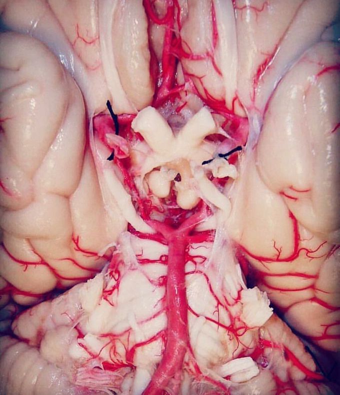 The Optic chiasm and the vascular system