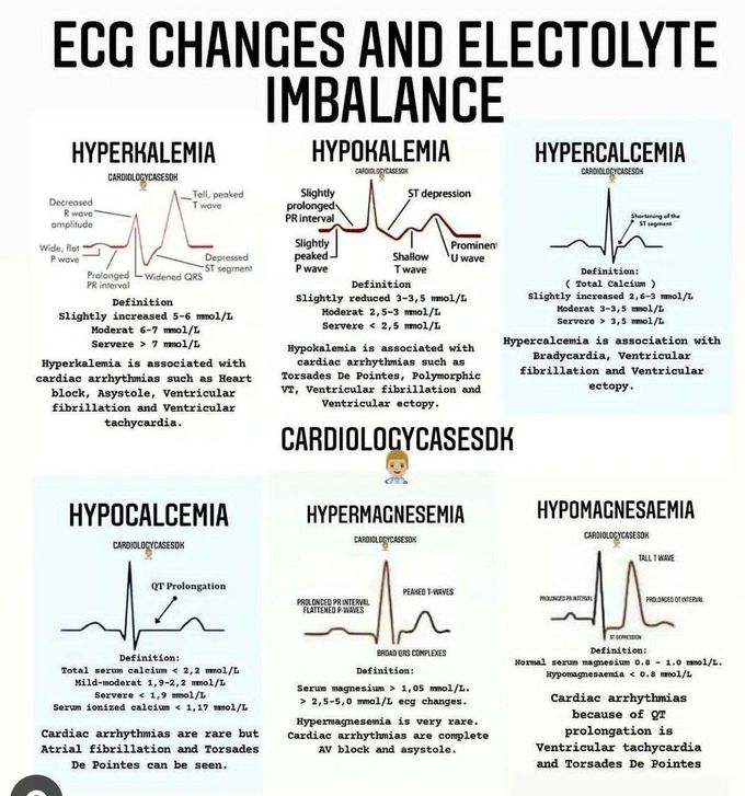 Ecg Changes