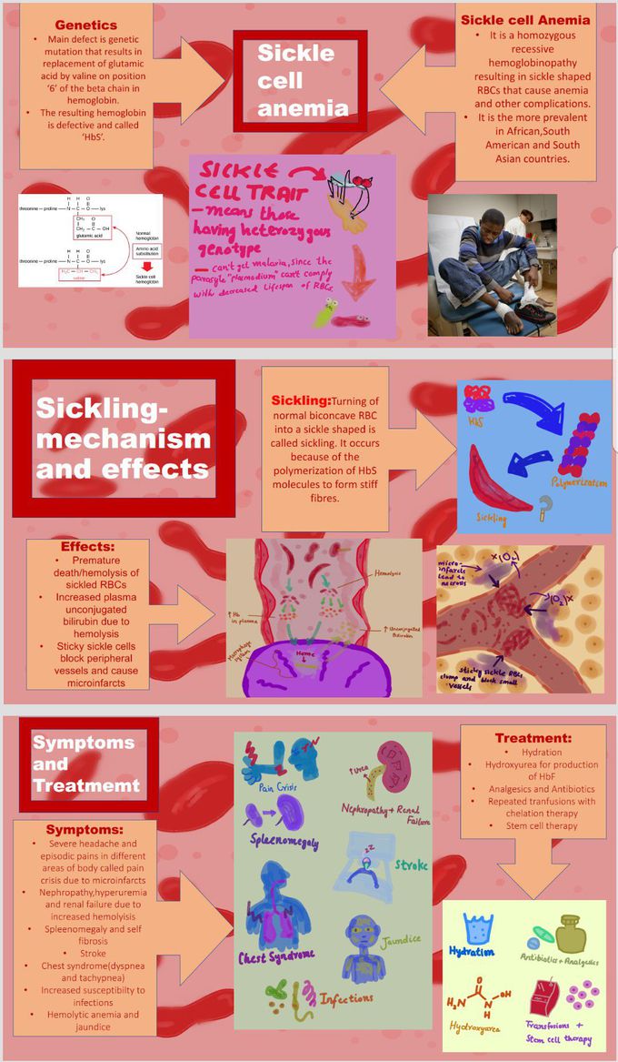 Presentation on Sickle cell anemia!
