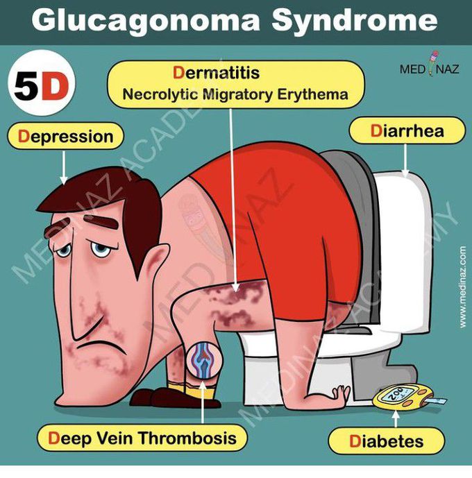 D'S of Glucagonoma