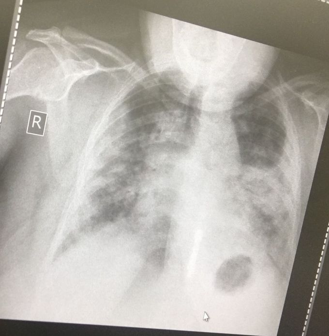 Patient came to emergency room