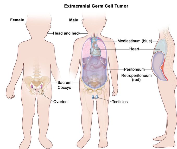 Germ cell tumours