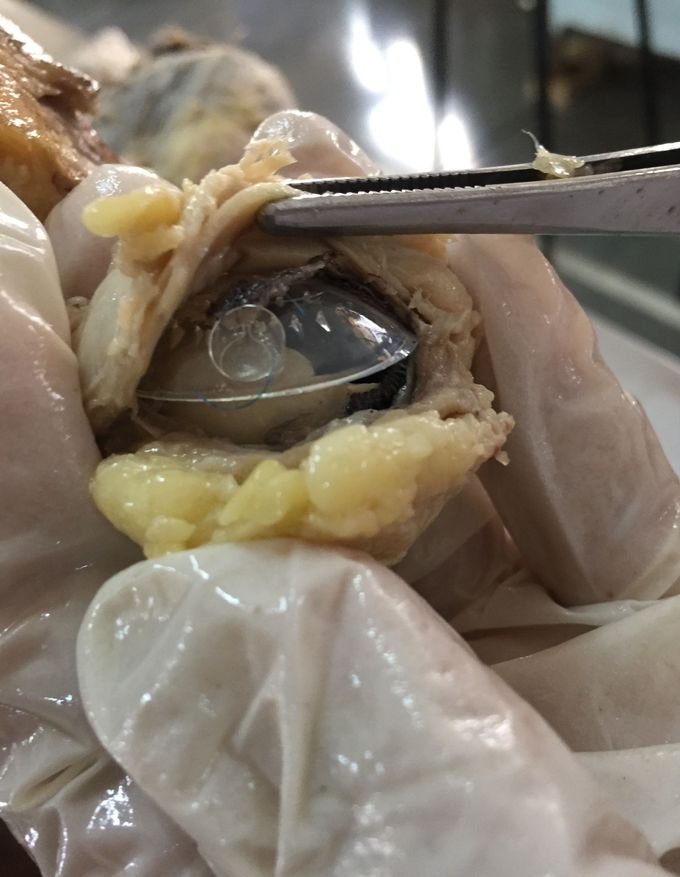 Eye dissection