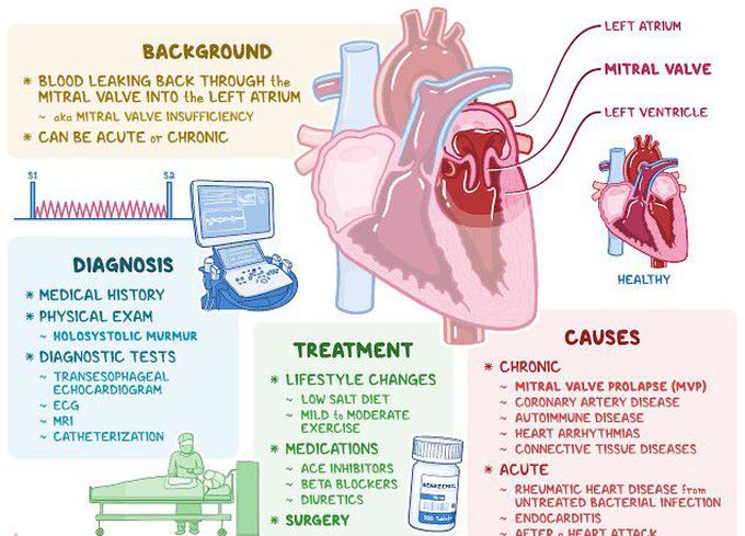 Mitral Regurgitation MEDizzy