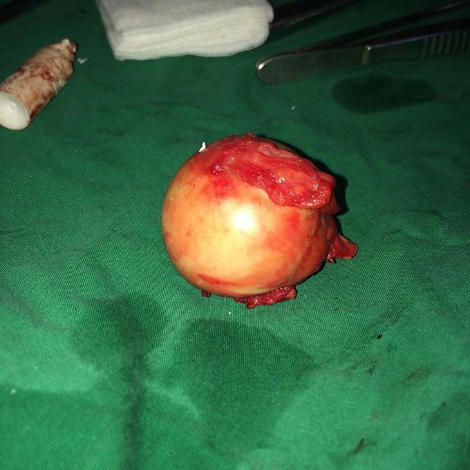 Balls...jajajajjaa...just kidding...that's a head of femoral bone...