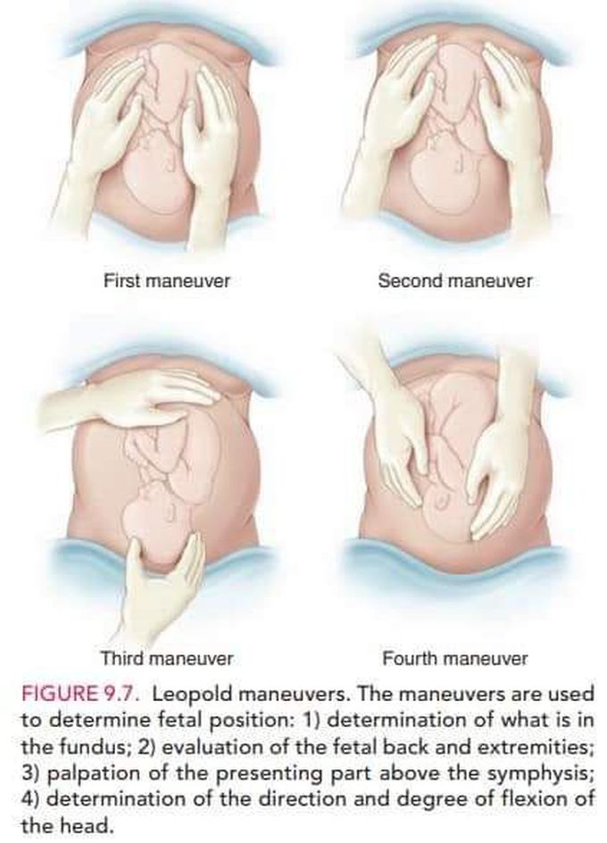 Method of obstical mannerver