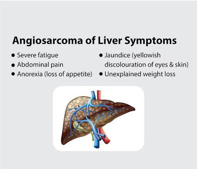 Angiosarcoma of Liver symptoms