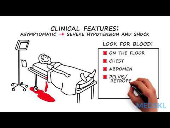 Vascular Injury-Animation