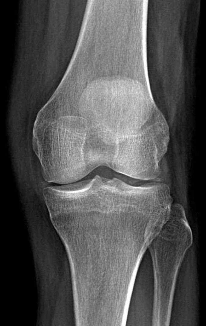 What is the diagnosis???