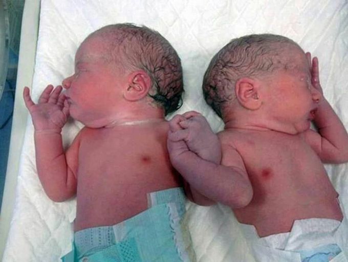 Twins for ever