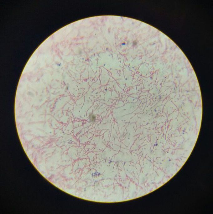 Gram negative bacilli - MEDizzy