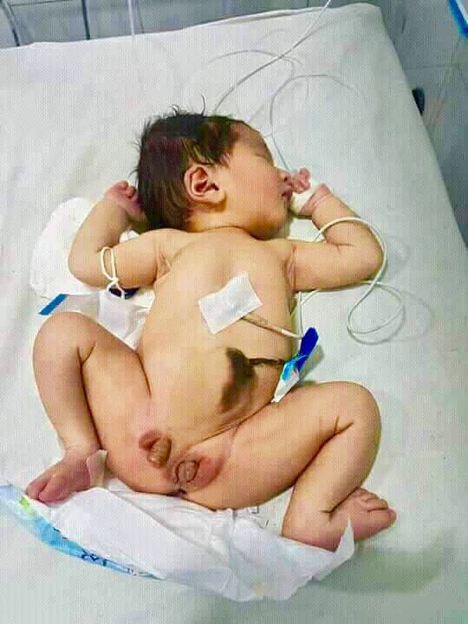 🌿Is dat possible to havin both reproductive organs in one ?